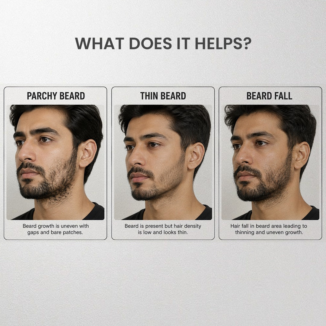 Velvaire beard oil before and after results for hair fall.