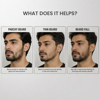 Velvaire beard oil before and after results for hair fall.